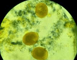 Coproparasitología
